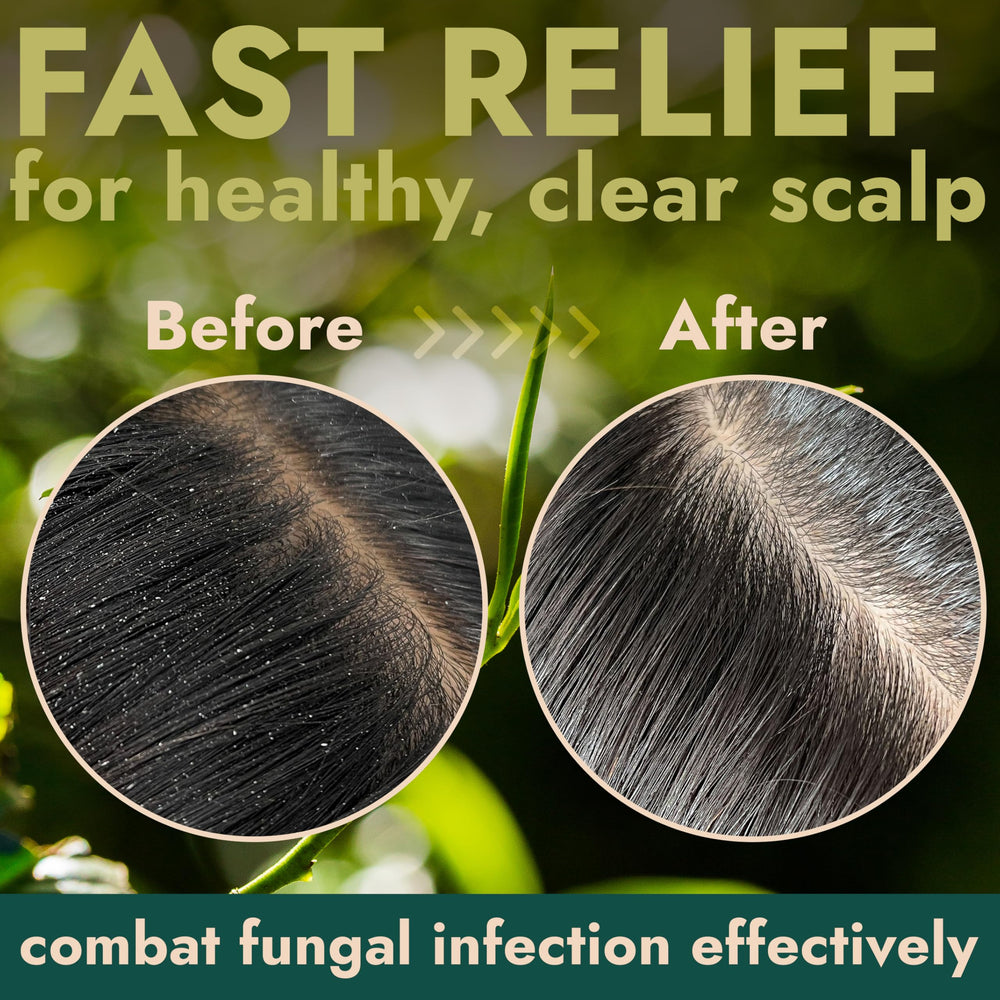 Terramed Just Think Comfort Tea Tree Scalp Scrub ingredients feature tea tree oil and natural exfoliants