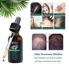Tgideas Rosemary Batana Oil dropper shows easy daily hair nourishment.