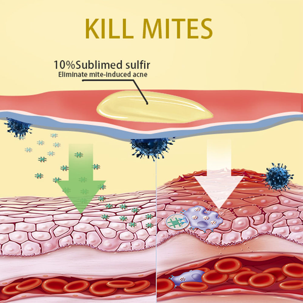 Tgideas sulfur soap skin-benefits image shows calm balanced skin potential