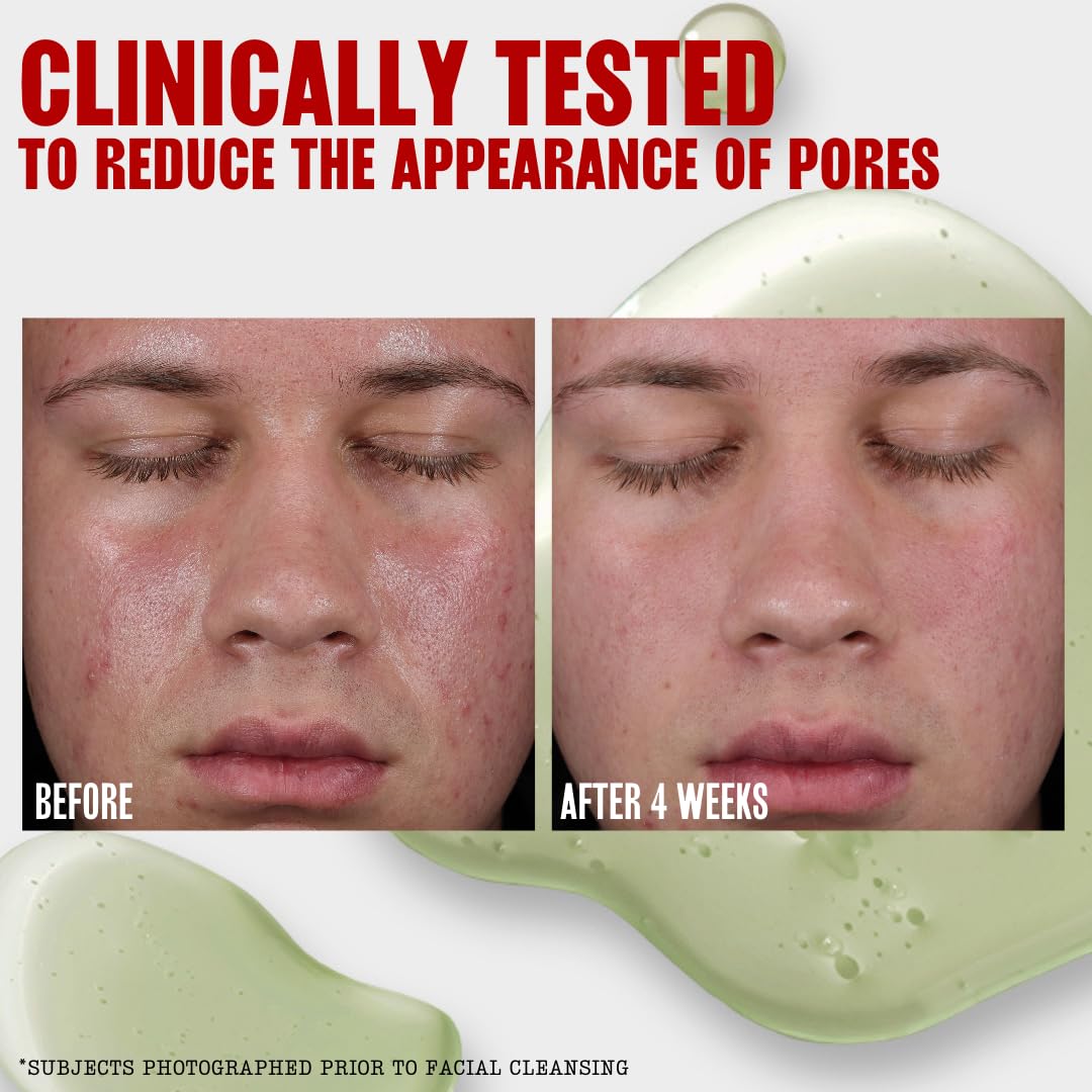 Green Kaolin Clay image highlights pore refining and balance for oily skin