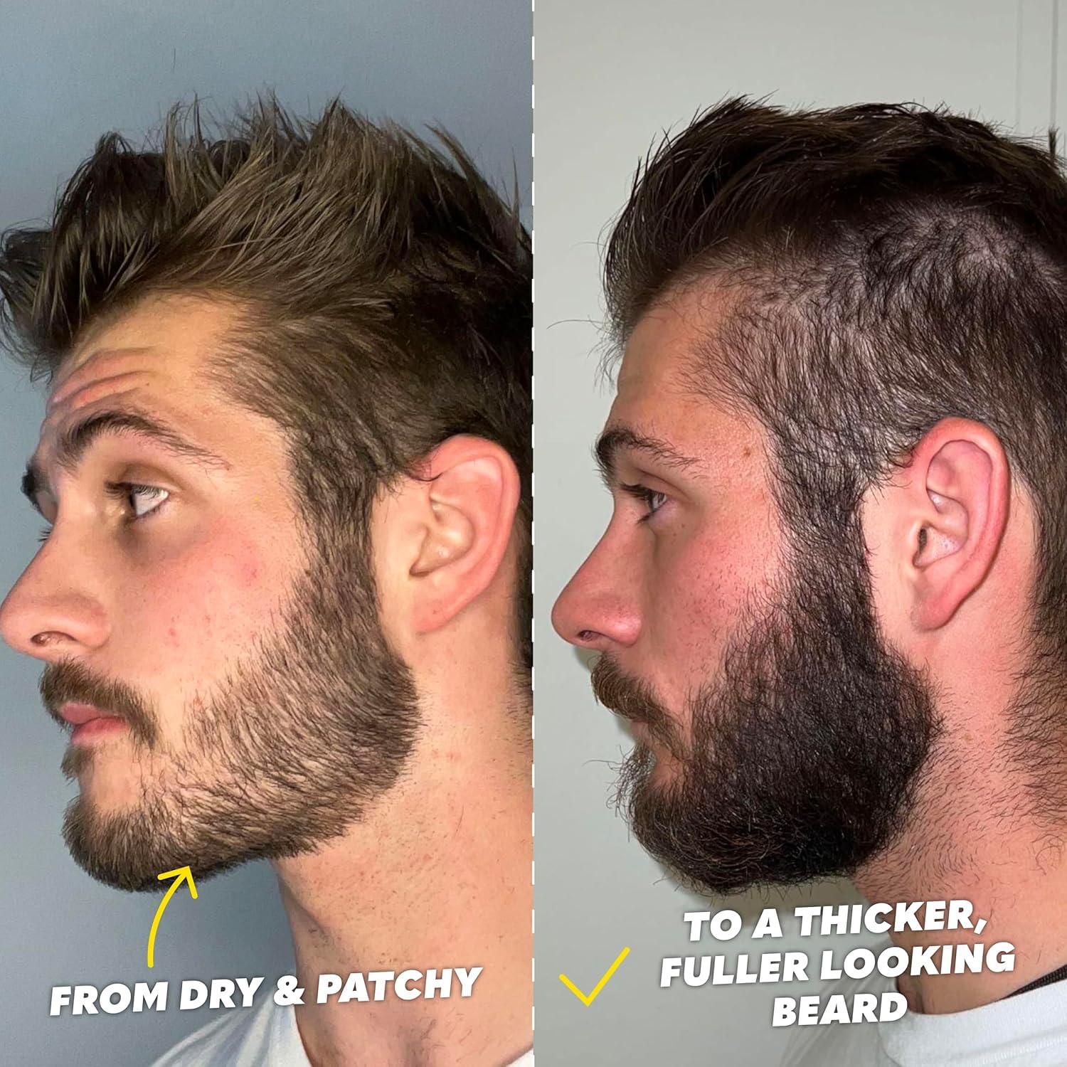 The Beard Club growth vitamins pack featuring essential beard nutrients