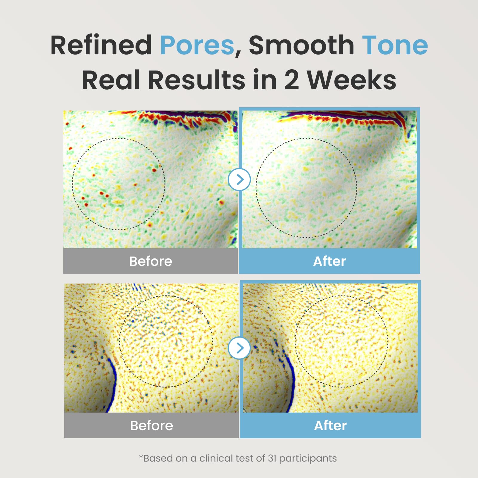 The Face Shop Alltimate Niacinamide 10% Serum dropper image showing caffeine drop for energizing skin.