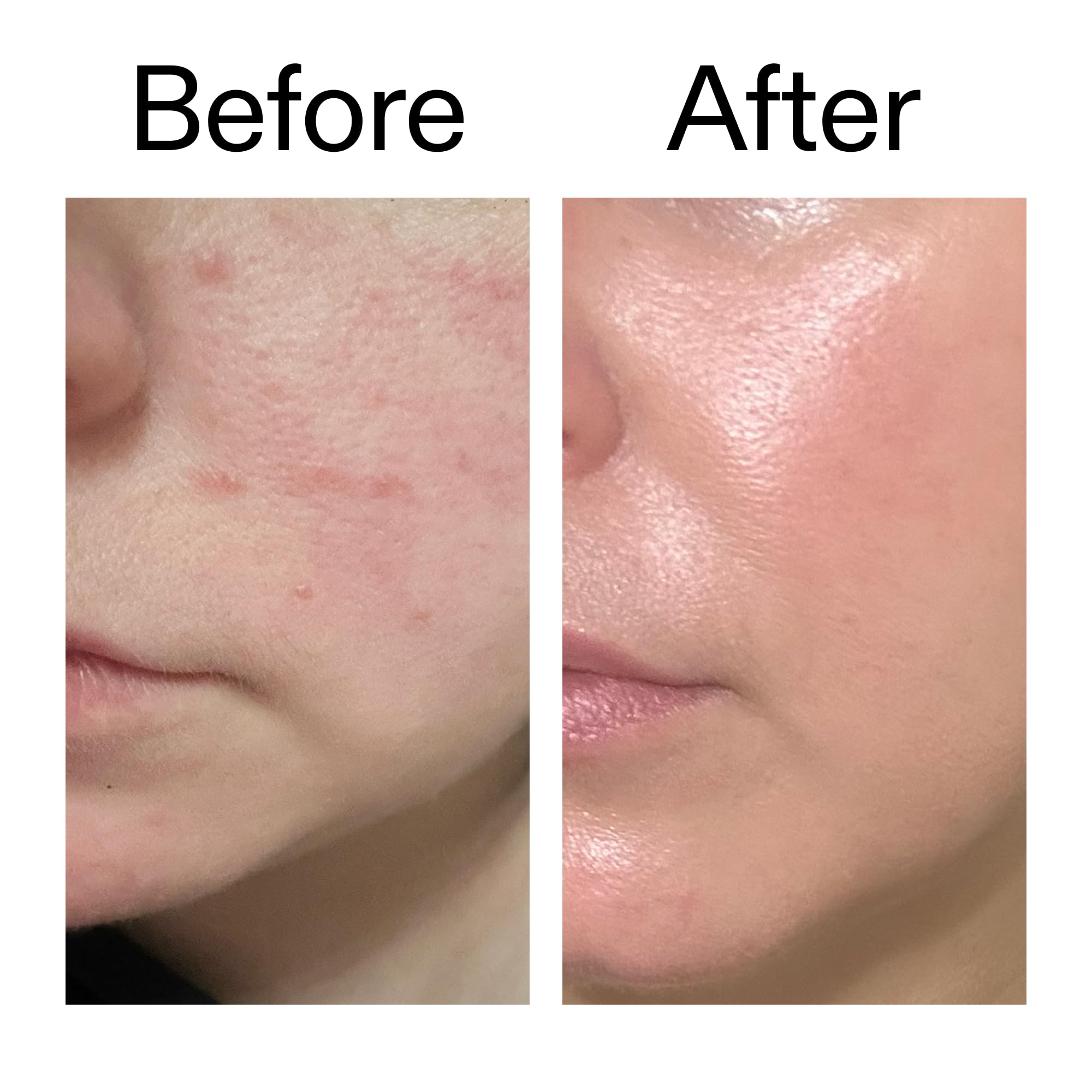Rejuvenated skin using The INKEY List Exosome Hydro-Glow Complex serum.