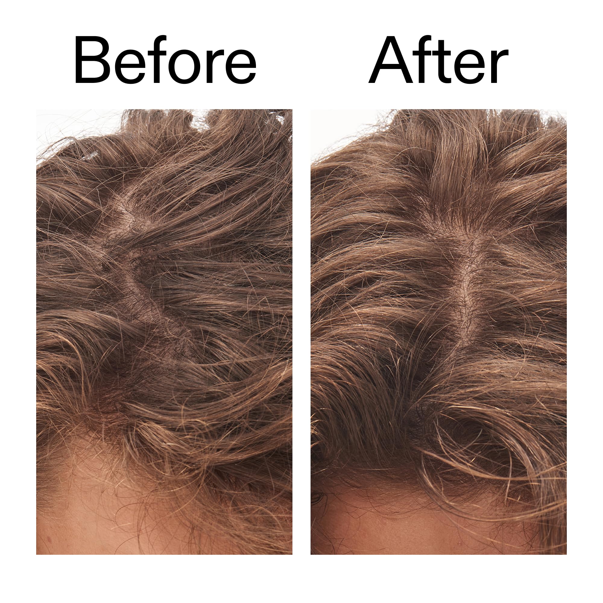 The INKEY List Glycolic Acid Exfoliating Scalp Scrub ingredients closeup hinting at exfoliating acids.
