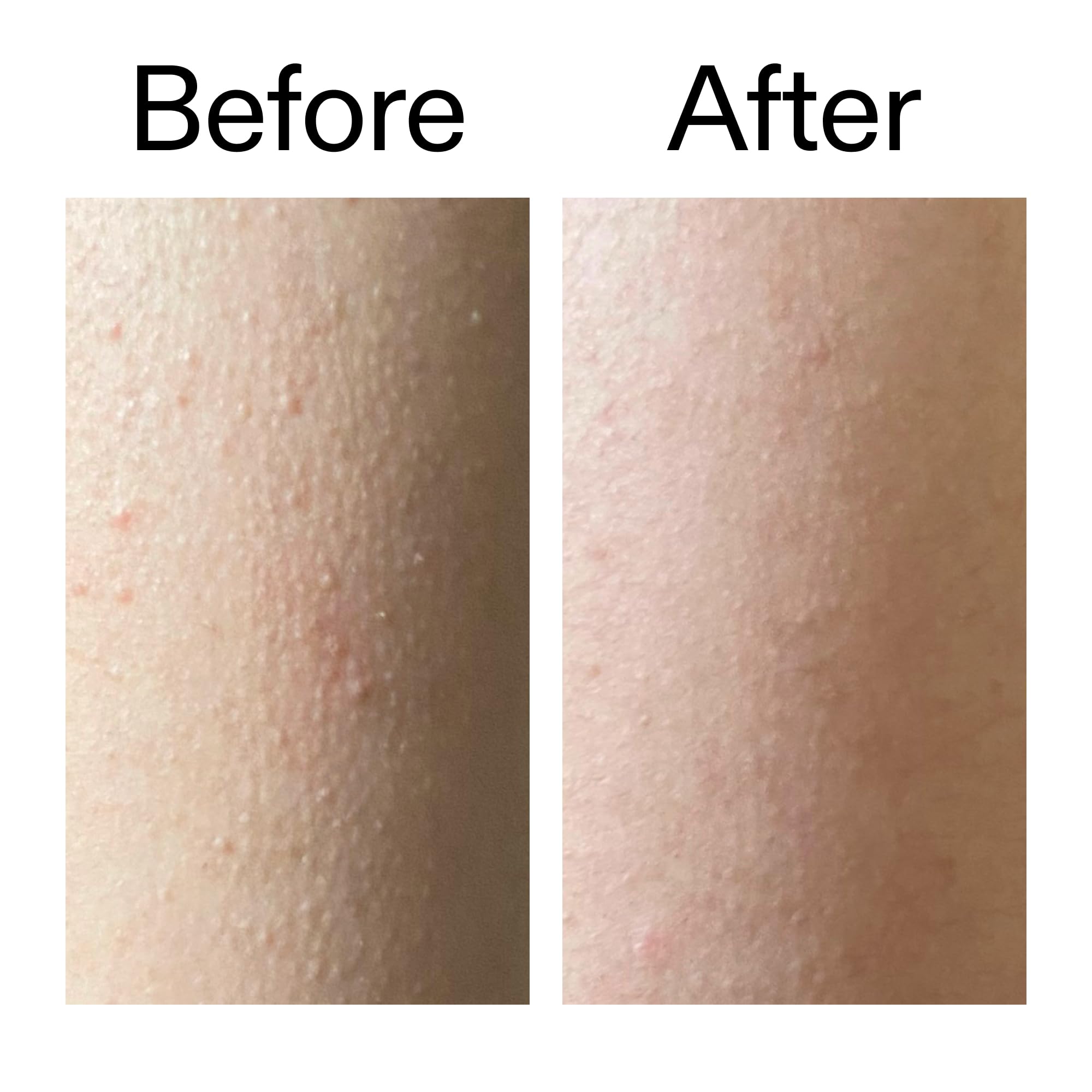 The INKEY List glycolic exfoliating body stick being used rinse-free for convenience.
