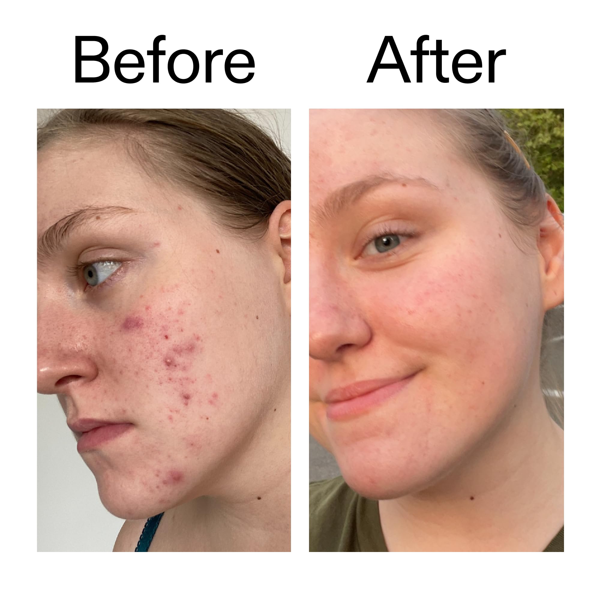 The INKEY List glycolic toner night-routine enhances brightness and texture