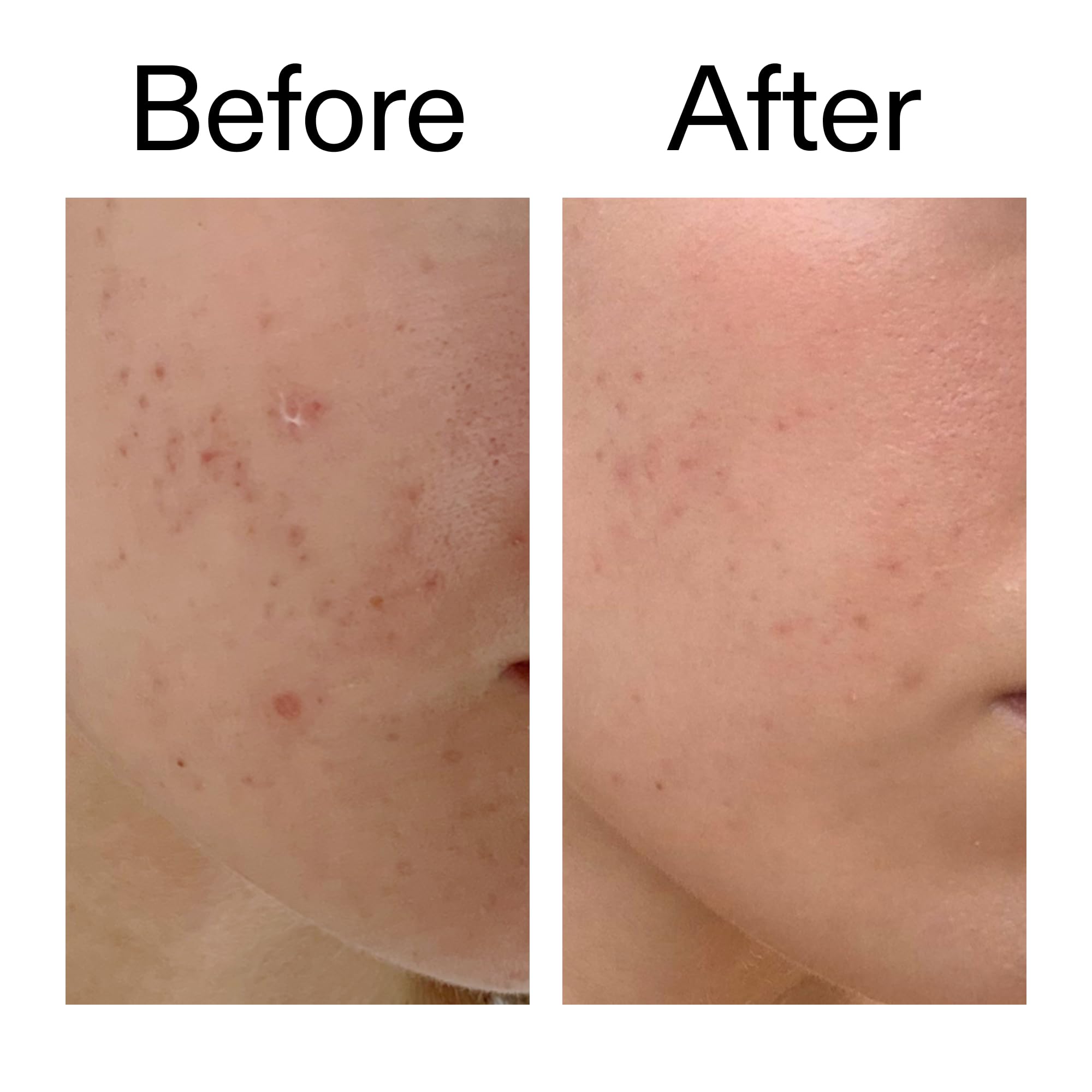 The INKEY List Mandelic Acid Treatment serum texture swirls smoothly on the skin