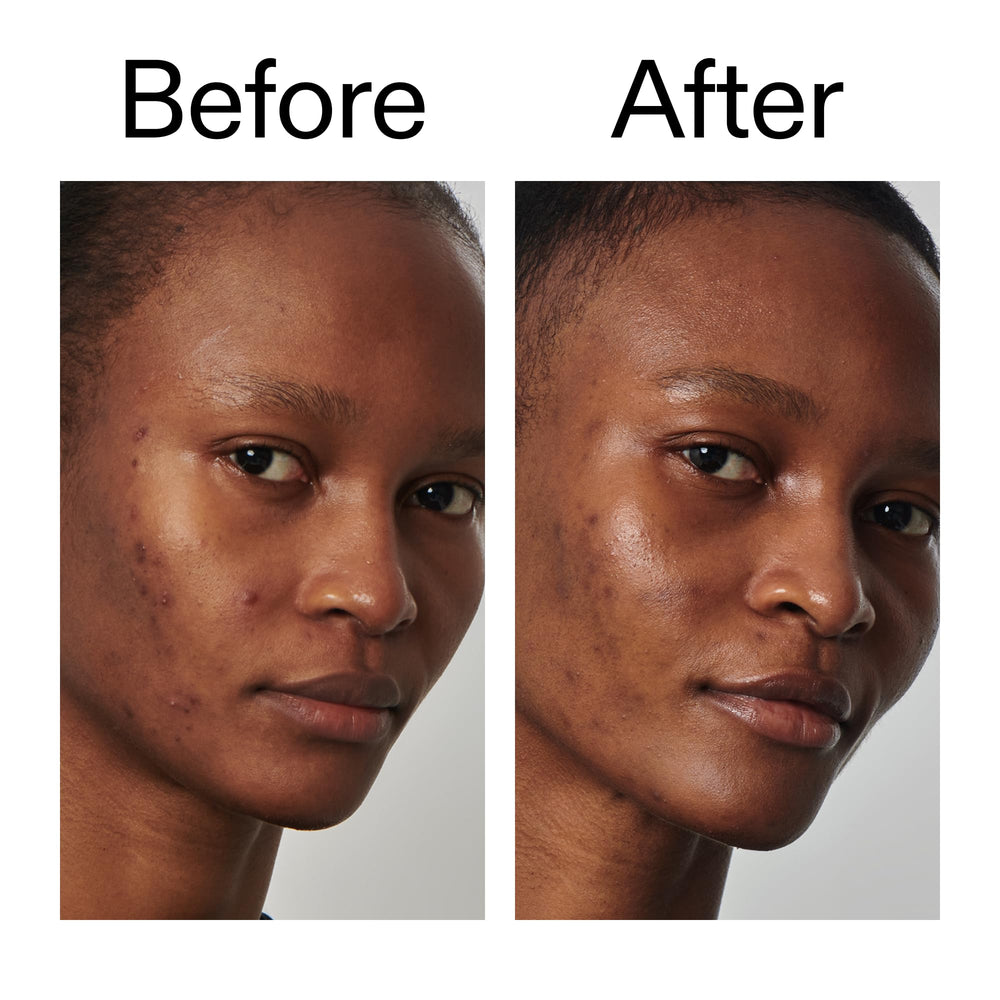 The INKEY List Niacinamide serum routine shot suggests a calm, everyday skincare ritual.