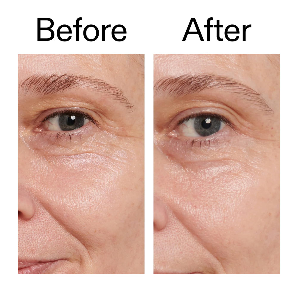 The INKEY List Retinol Eye Cream flat lay with ingredients hinting at gentle formulation