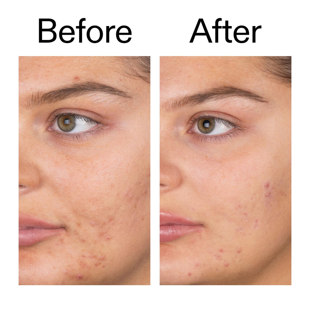 The INKEY List Salicylic Acid Cleanser packaging box shows 5.0 oz size and value.