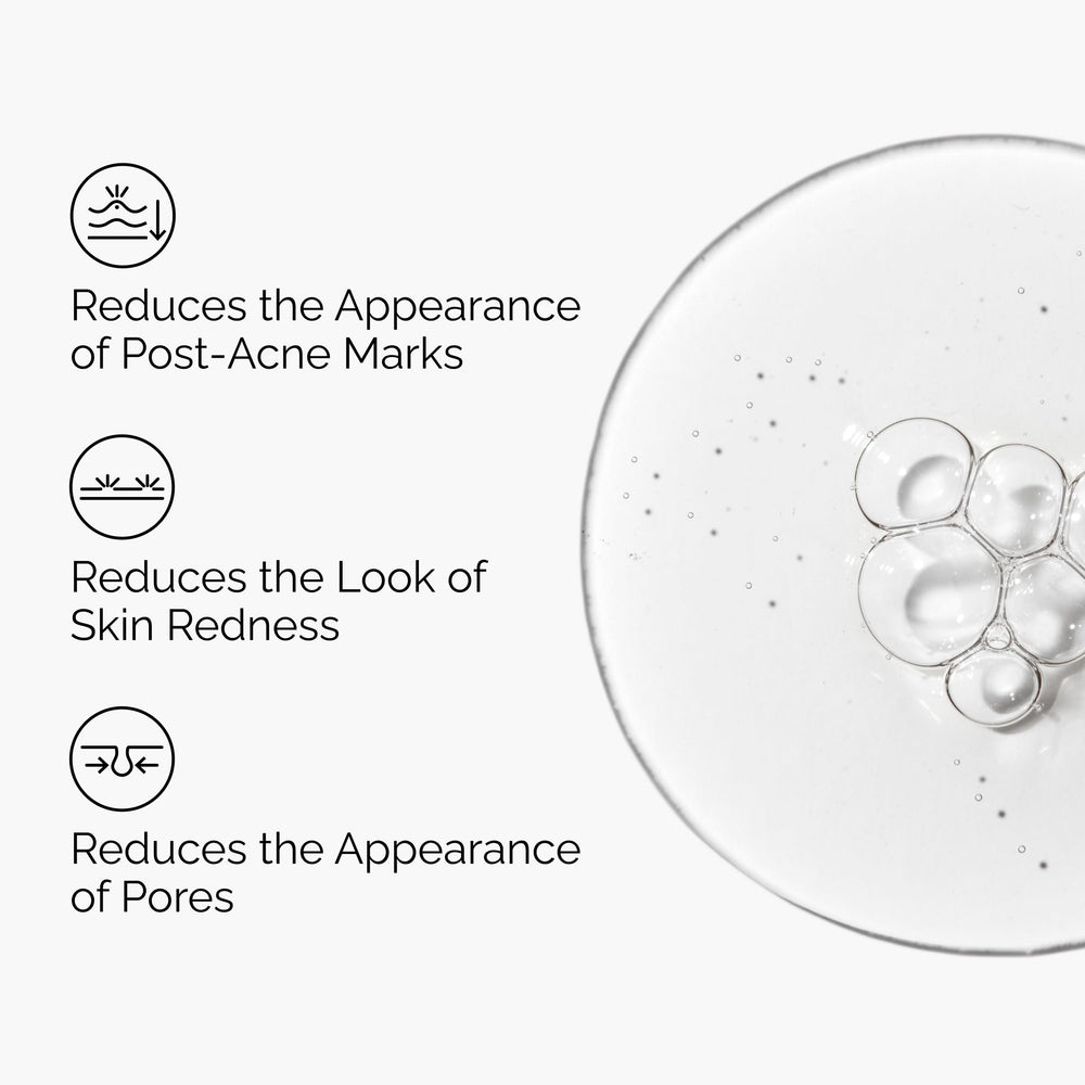 The Ordinary Aloe 2% + NAG 2% serum dropper enables precise application.