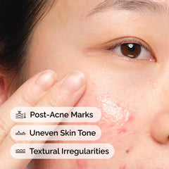The Ordinary Aloe 2% + NAG 2% swirl shows texture-smoothing potential.