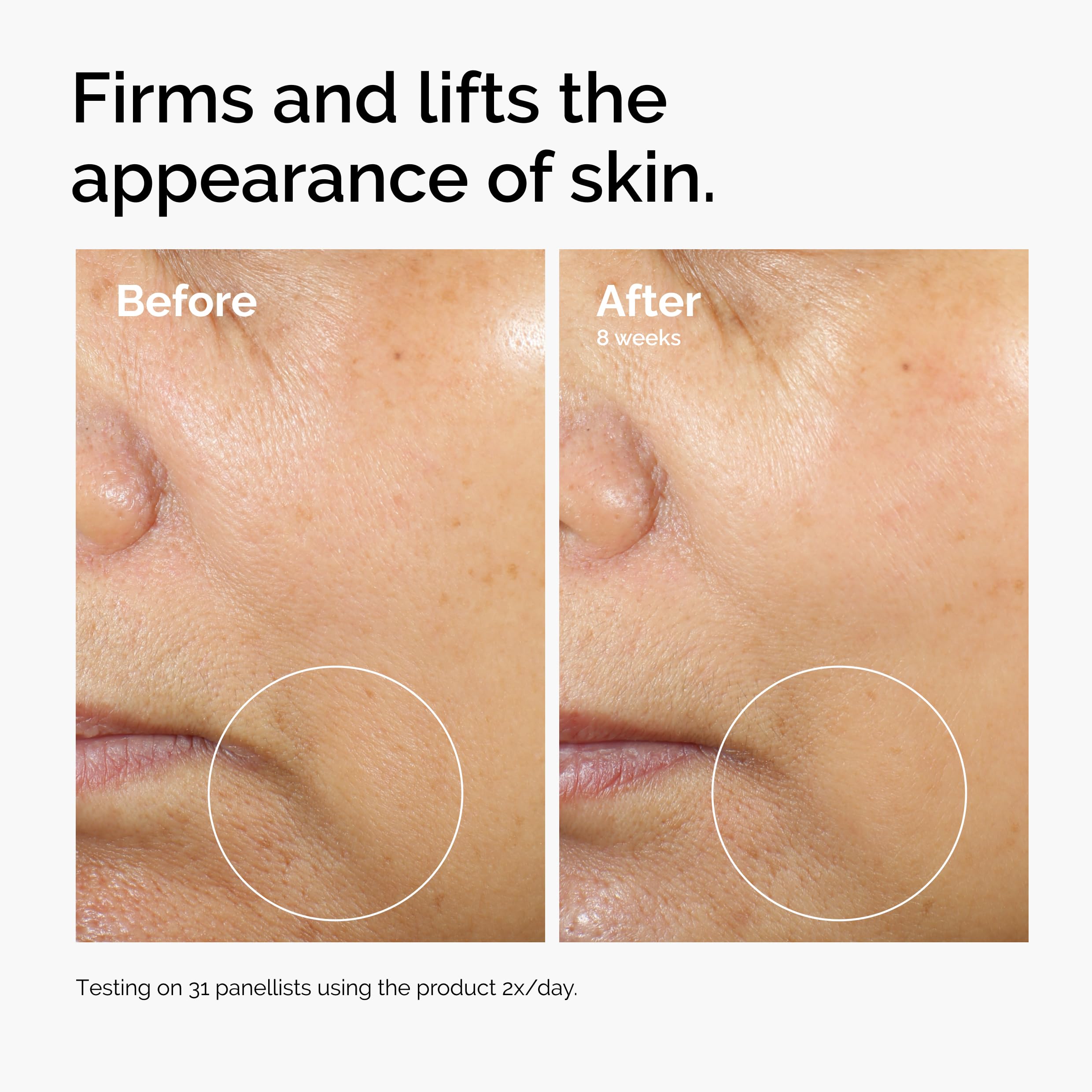The Ordinary Caffeine 3% + Escin 1% serum packaging and labeling details.