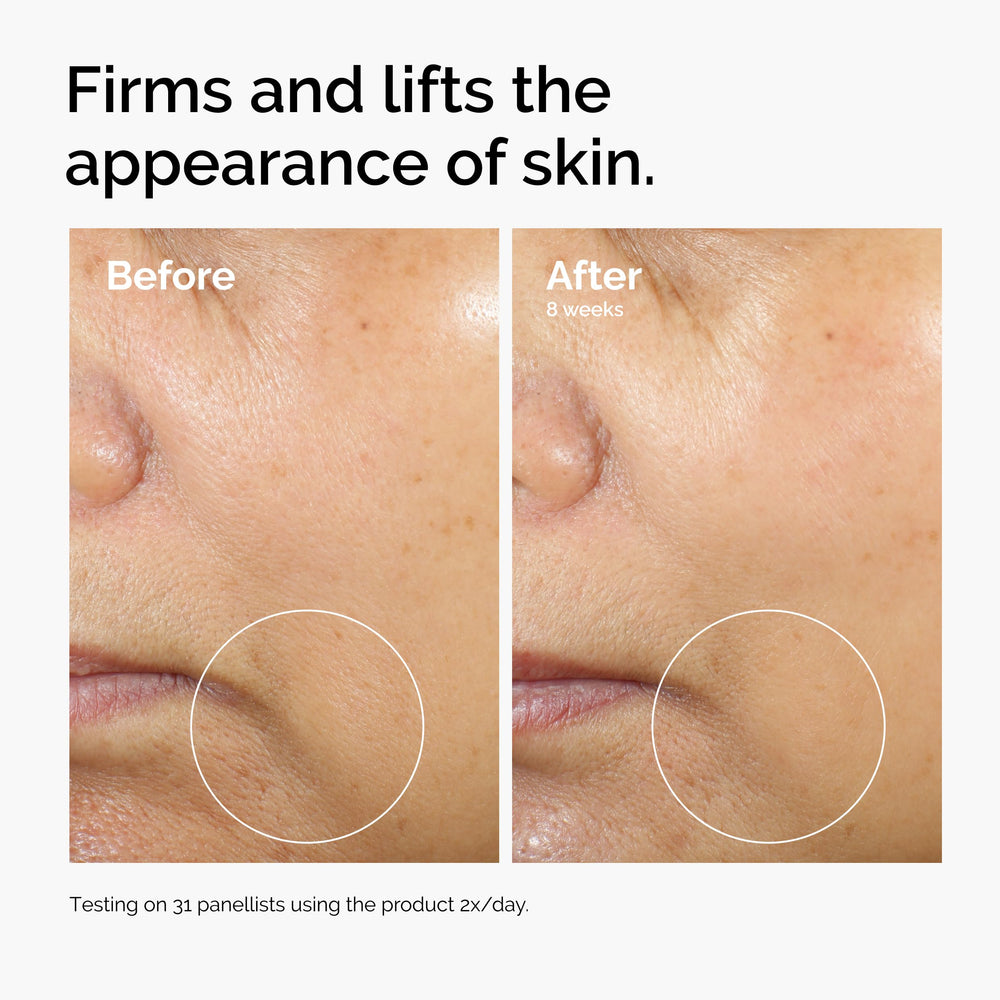 The Ordinary Caffeine 3% + Escin 1% serum packaging and labeling details.