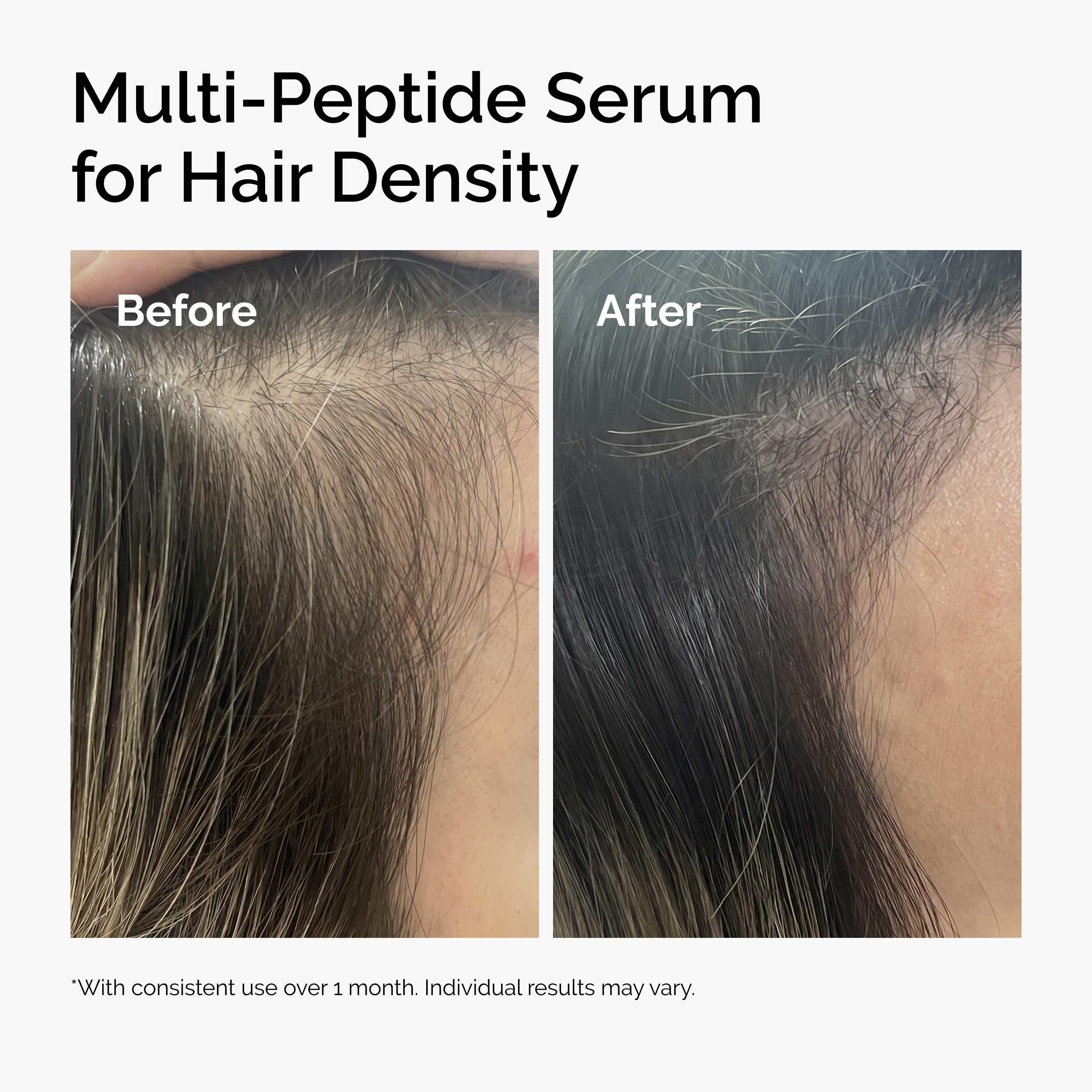 Hair strands showing improved volume after applying The Ordinary serum on the scalp.