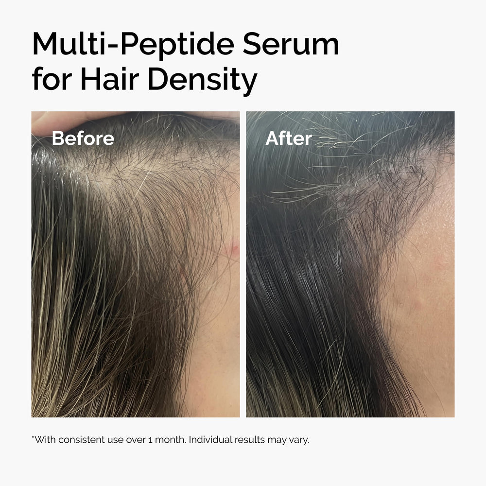 Hair strands showing improved volume after applying The Ordinary serum on the scalp.