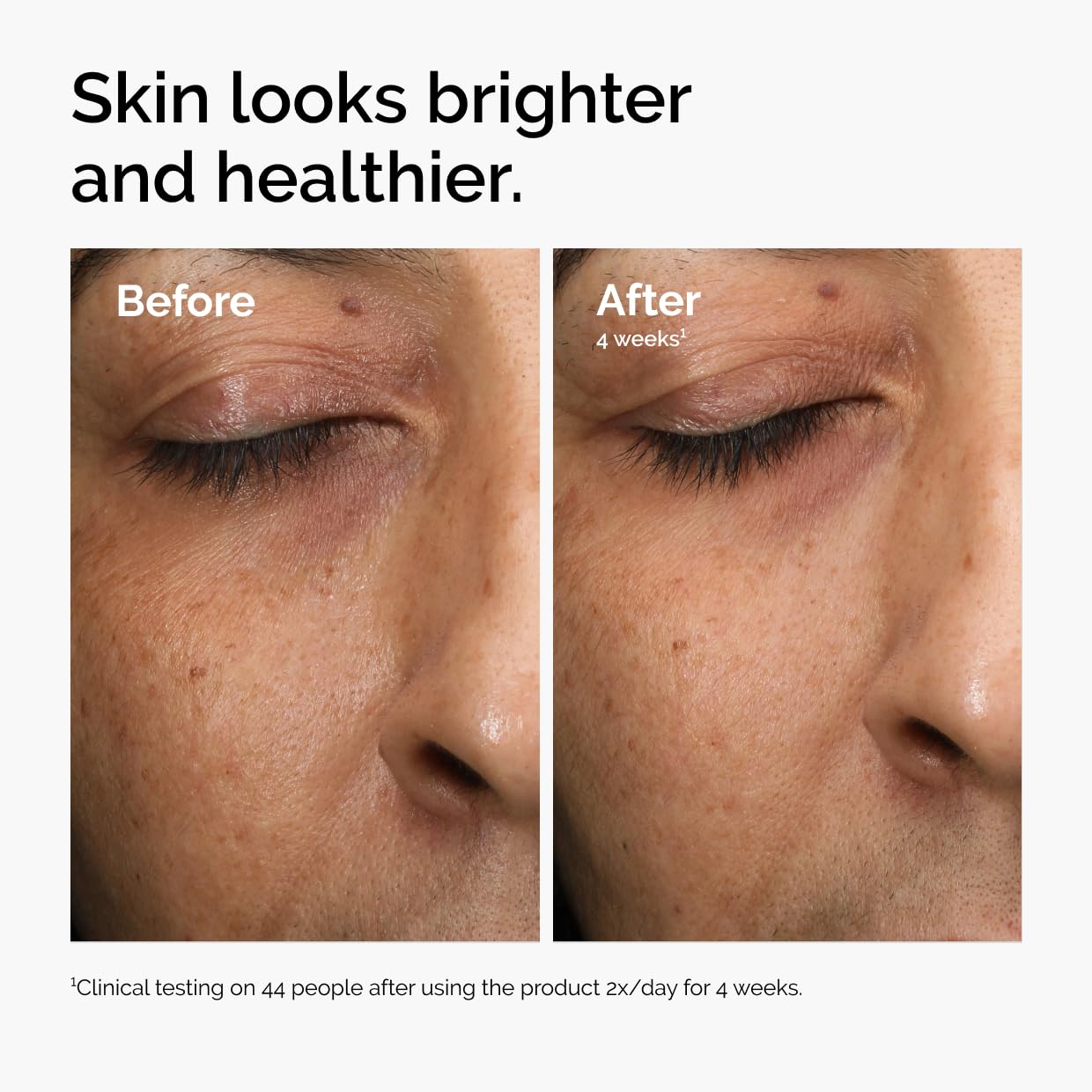 The Ordinary Radiance Serum applied on skin for a dewy glow.