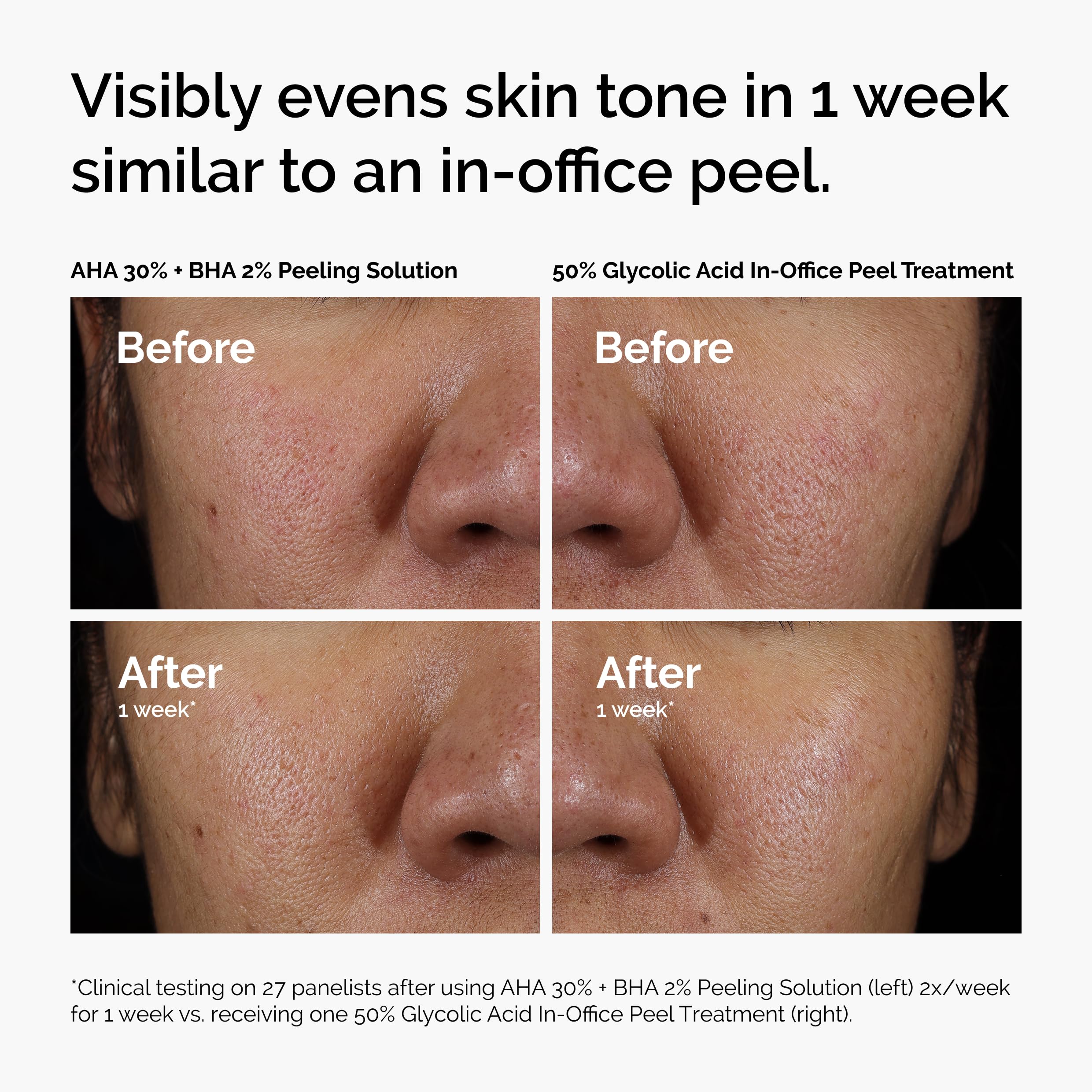The Ordinary Peeling Solution ingredients banner highlights tasmanian pepperberry and hyaluronic acid.