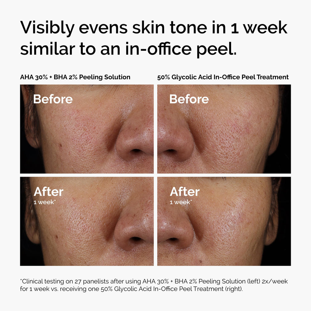 The Ordinary Peeling Solution ingredients banner highlights tasmanian pepperberry and hyaluronic acid.
