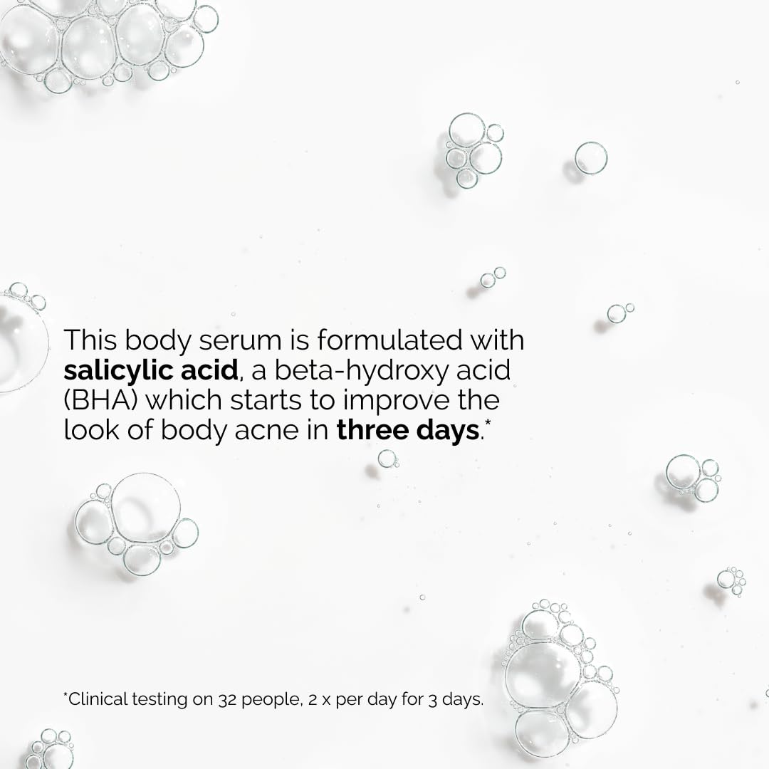 The Ordinary Salicylic Acid 0.5% Body Serum applied to skin highlights targeted spot treatment.