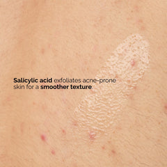 The Ordinary Salicylic Acid 0.5% Body Serum on close-up pores emphasizes exfoliation.