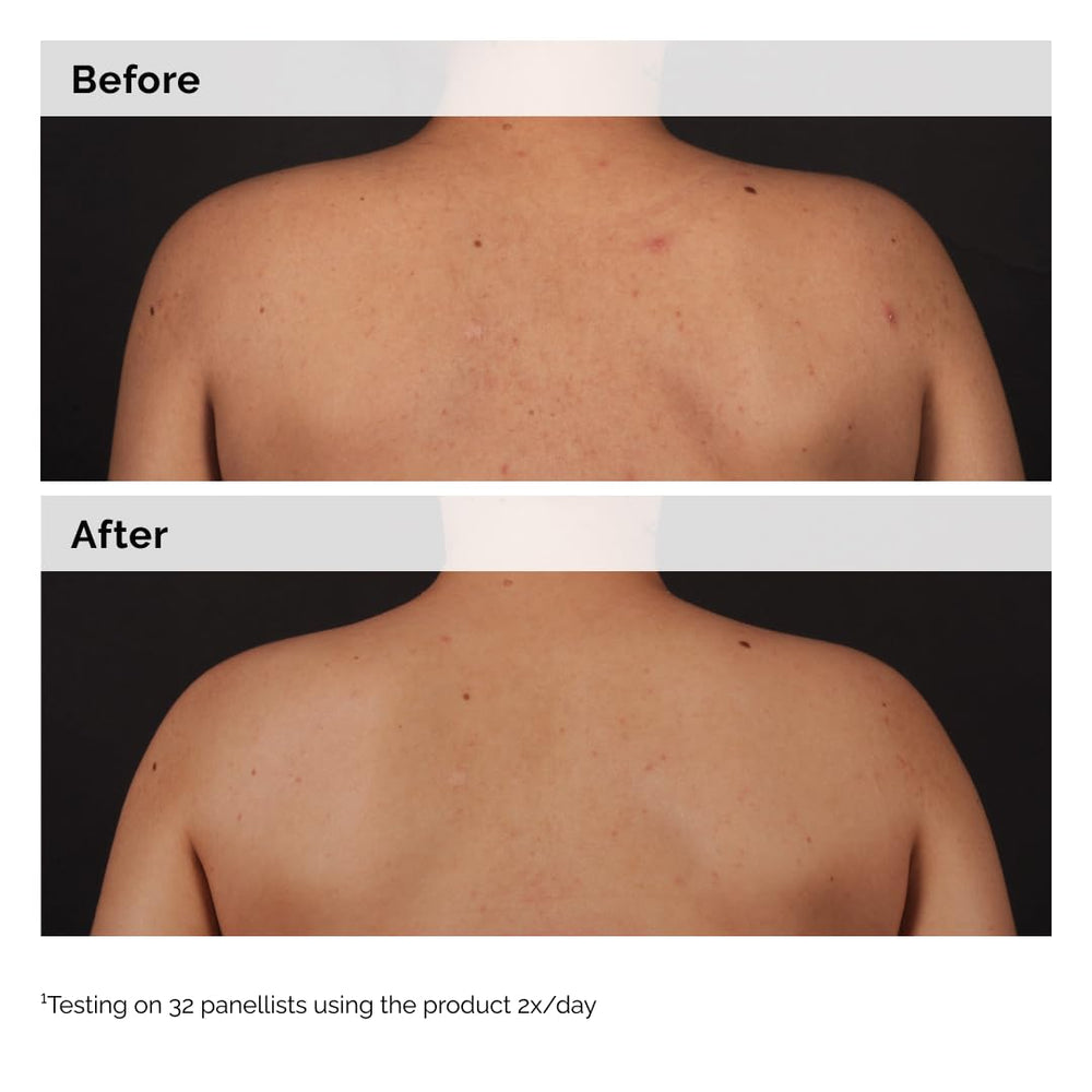 The Ordinary packaging scene communicates clear, simple body care routine and routine use.