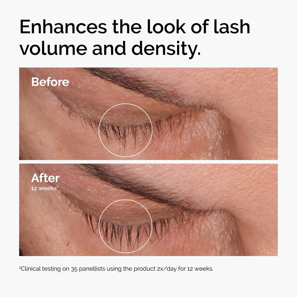 The Ordinary serum packaging highlighting lightweight, non-greasy formula