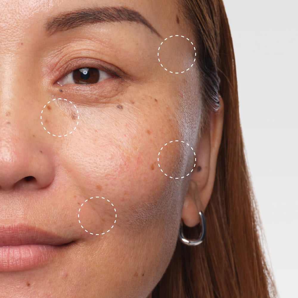 The Ordinary Volufiline applied to the cheek area targeting volume loss