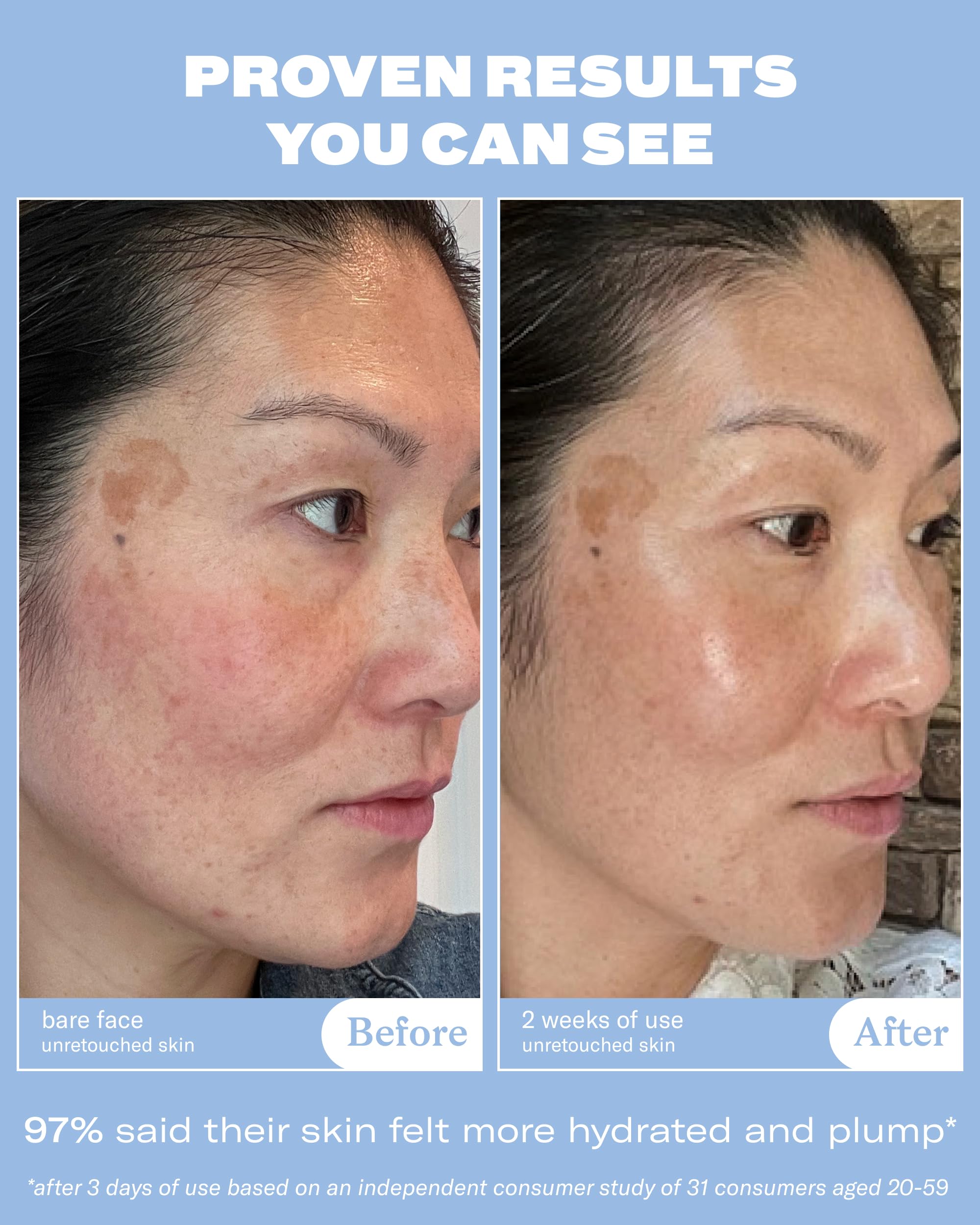 Then I Met You The Giving Essence ferment filtrate features soothing skin balance.