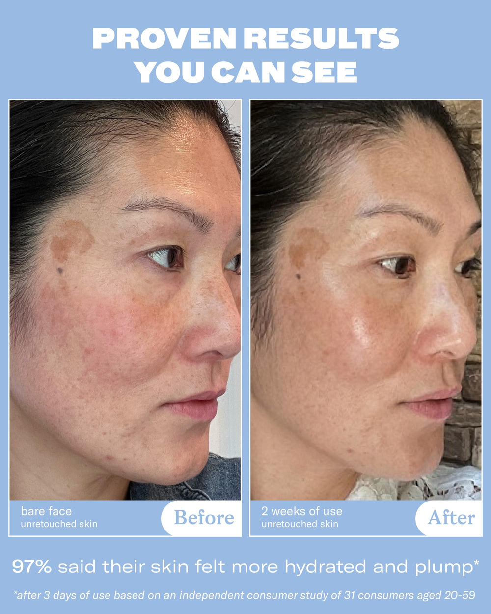 Then I Met You The Giving Essence ferment filtrate features soothing skin balance.