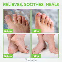 Thena foot cream menthol cooling delivers a refreshing sensation after use.