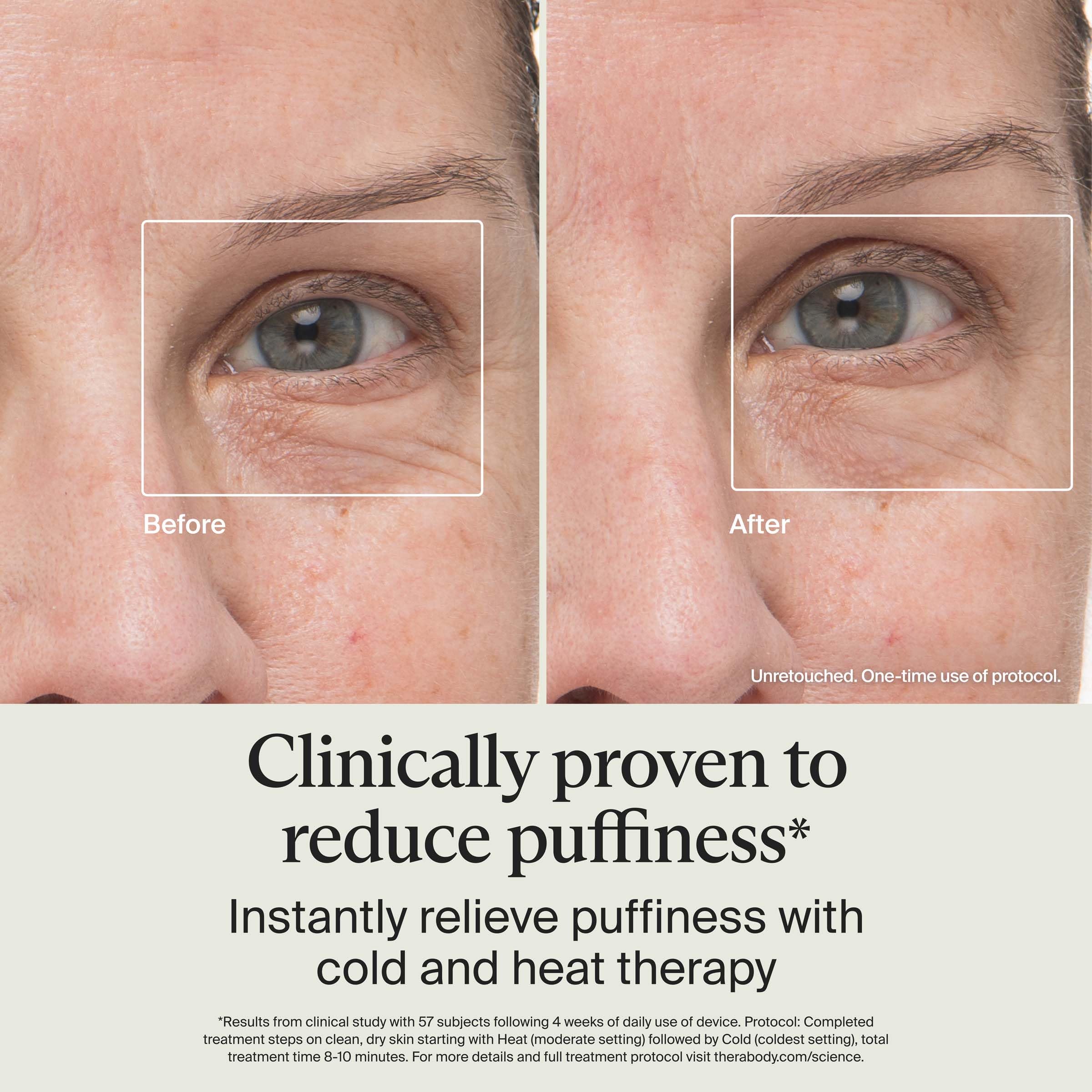 TheraFace Depuffing Wand contoured tip targets under-eye area for precise depuffing.