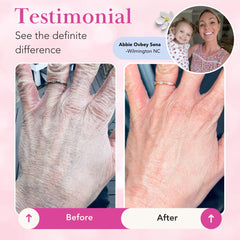 Theraplex NEA Seal closeup signals trusted eczema-support credential.
