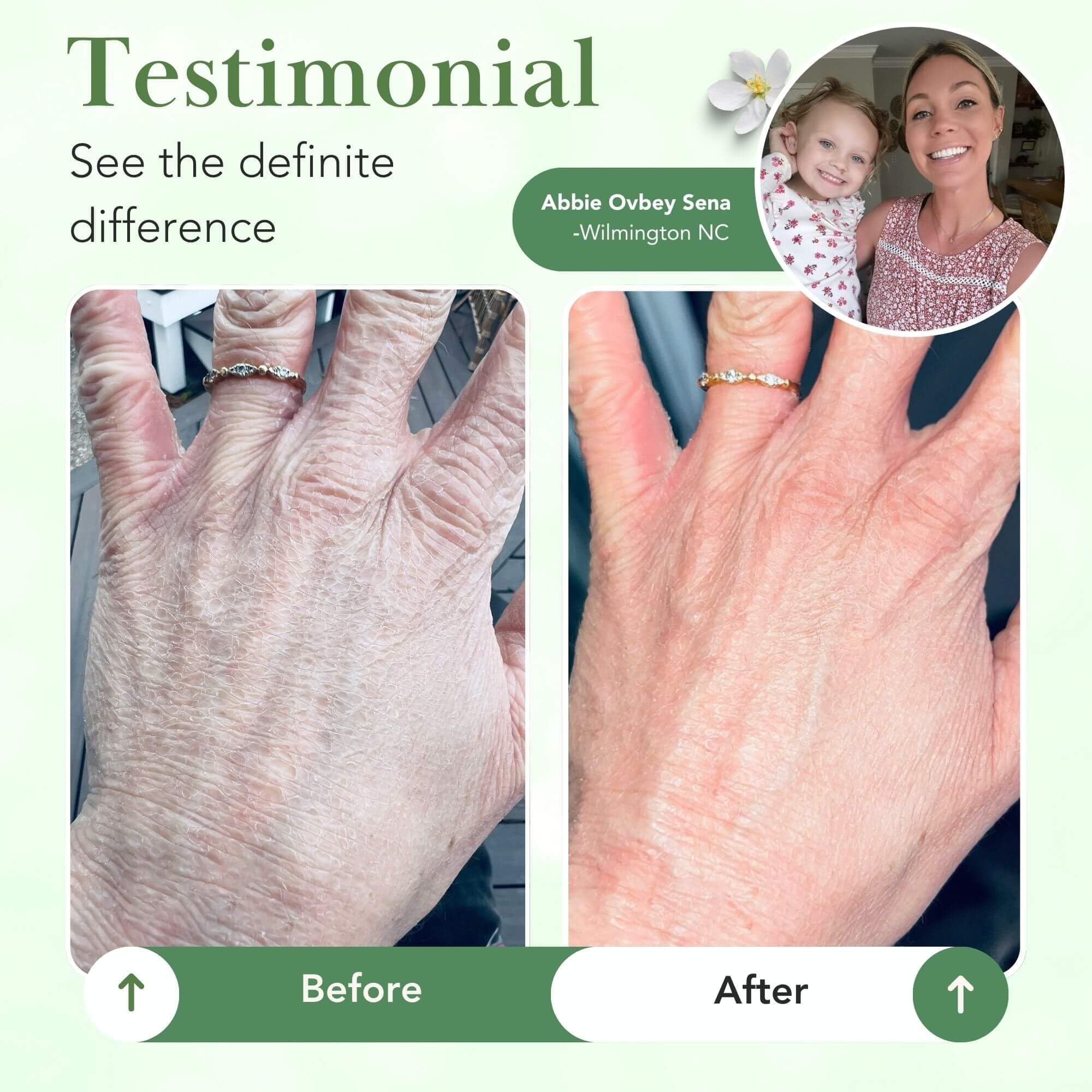 Fragrance-free label signals Theraplex balm for fragrance-sensitive skin.