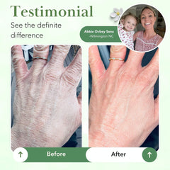 Fragrance-free label signals Theraplex balm for fragrance-sensitive skin.