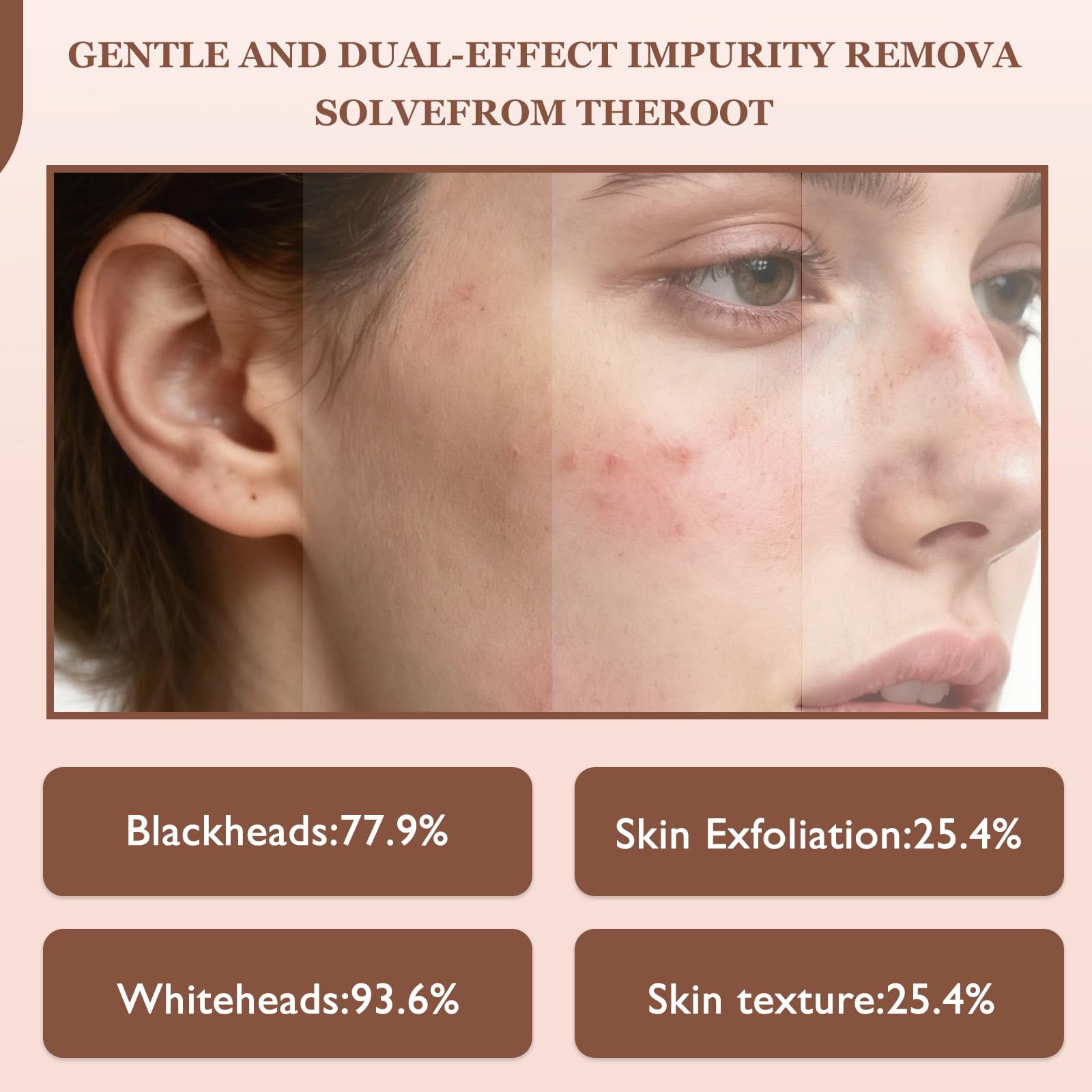 THESHYING Hydration boost closeup reveals plump, dewy skin potential