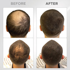 THICK FIBER being applied to dry thinning hair for quick coverage.