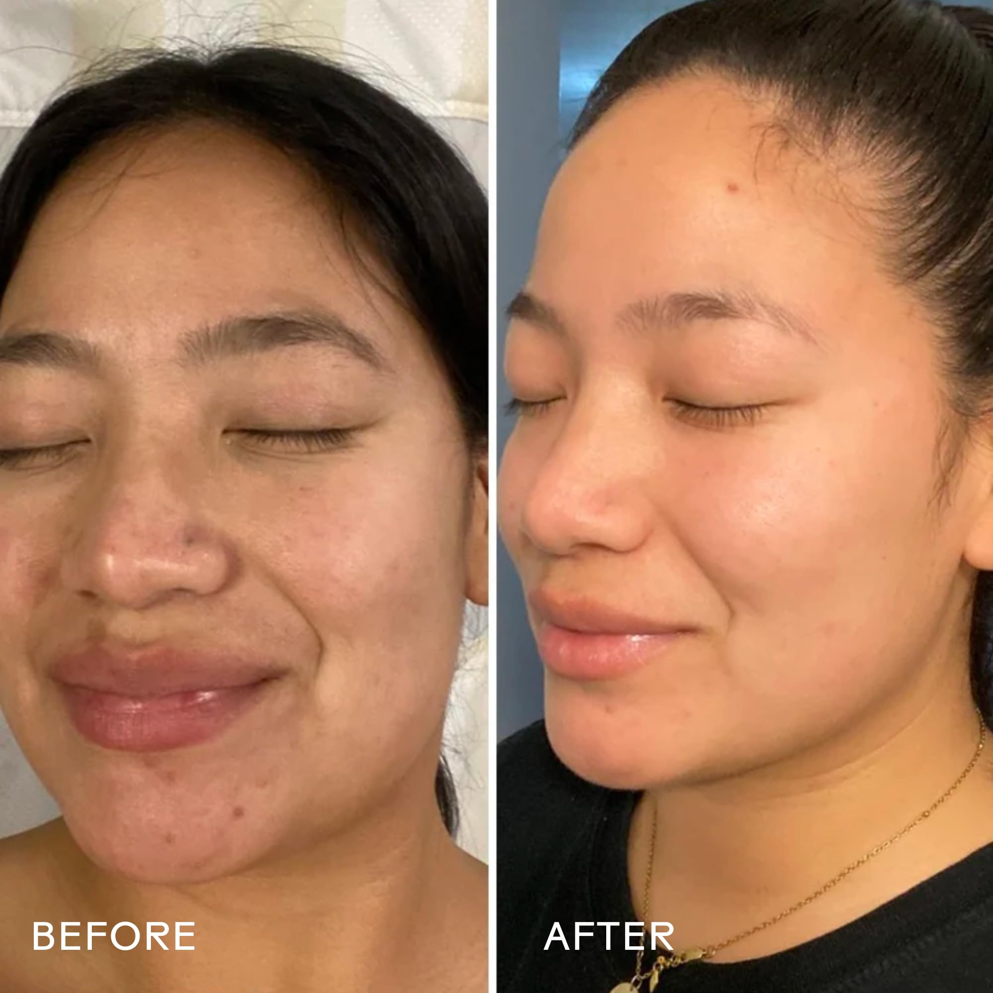 Three Ships Dream Bio-Retinol Cream even skin tone visual suggests balanced glow.