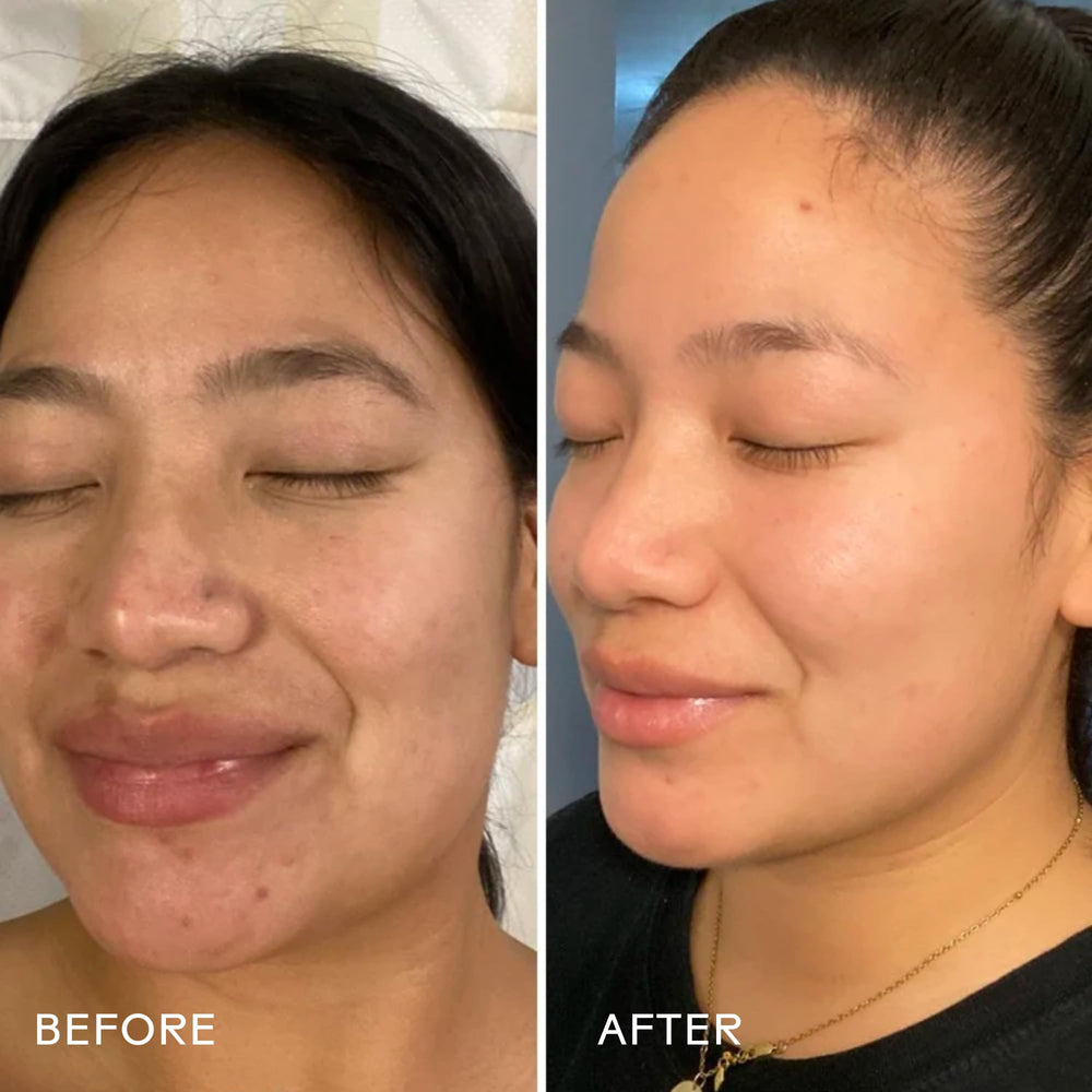 Three Ships Dream Bio-Retinol Cream even skin tone visual suggests balanced glow.
