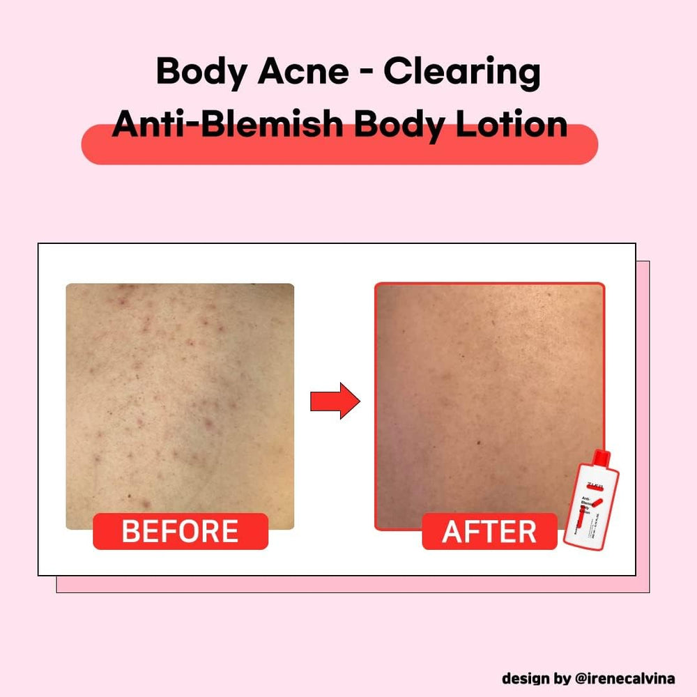 Niacinamide in TIAM lotion supporting balanced skin texture.