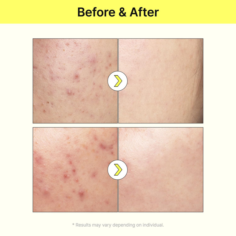 TIA'M Vita B3 Source image with niacinamide-arbutin icon suggesting discoloration improvement potential.