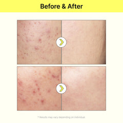 TIA'M Vita B3 Source image with niacinamide-arbutin icon suggesting discoloration improvement potential.