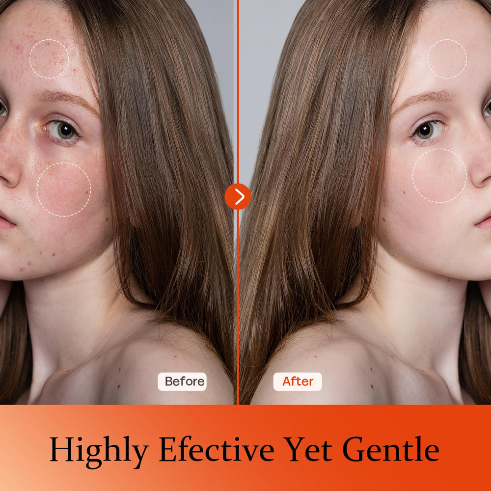 Tinclen Vitamin C Serum 3-O-Ethyl Ascorbic Acid boosts brightness.