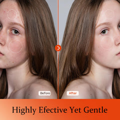 Tinclen Vitamin C Serum 3-O-Ethyl Ascorbic Acid boosts brightness.