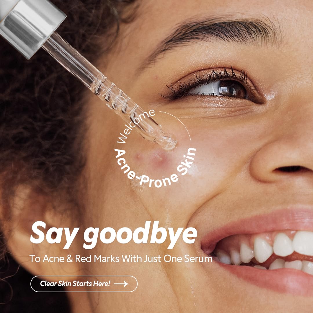 TIRTIR azelaic serum texture close-up highlights smoothing and even tone potential