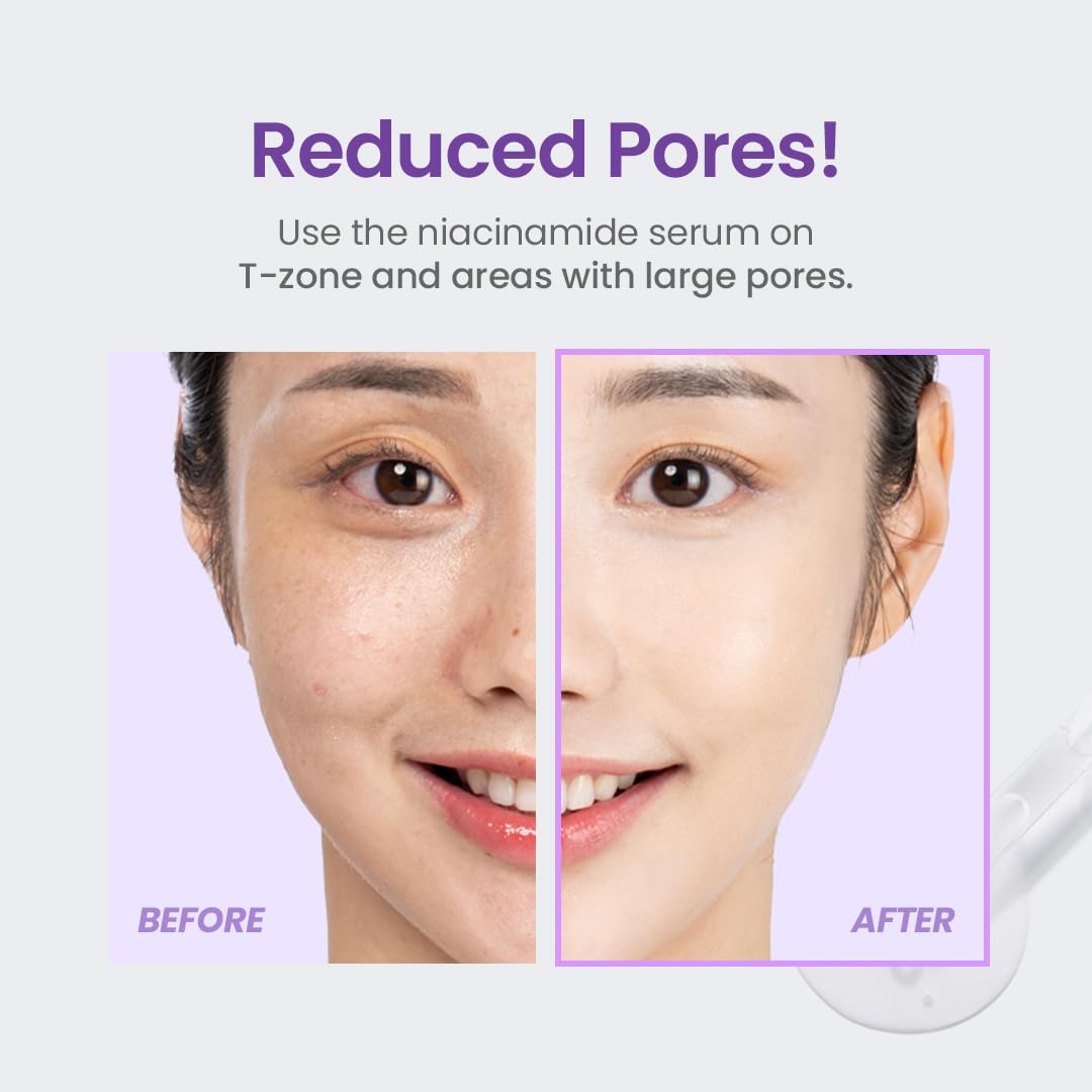 TIRTIR Niacinamide serum on face demonstrates a balanced, even complexion.