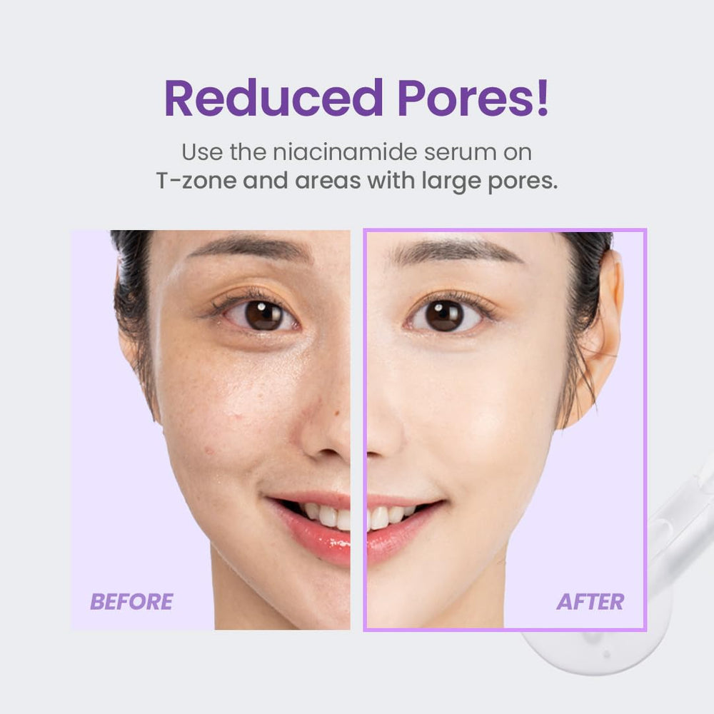 TIRTIR Niacinamide serum on face demonstrates a balanced, even complexion.