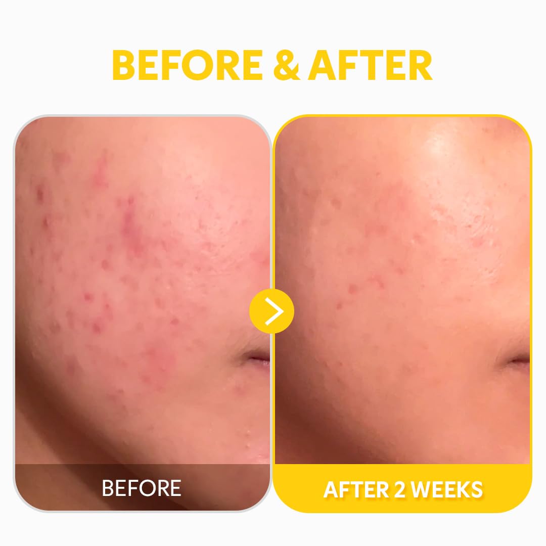 TIRTIR reminder to use SPF 30+ during daytime after serum