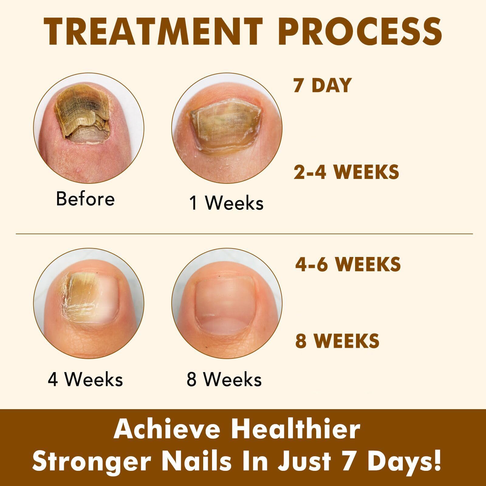 Tiuedu Nails Health hands closeup suggests healthier nails and cuticles from regular care