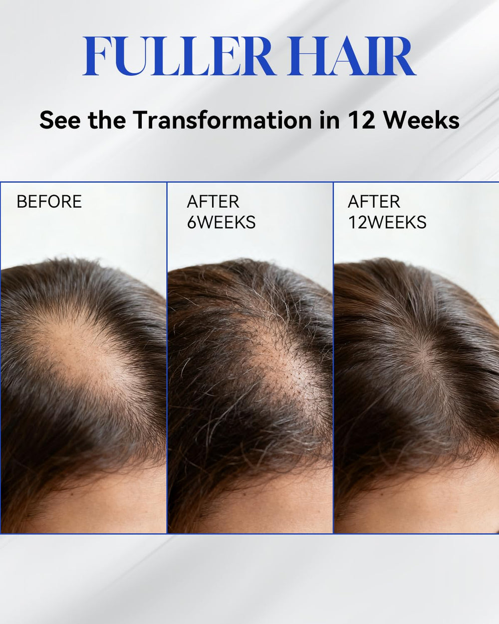 TJE Hair Growth Serum Roll-On nozzle close-up highlighting design.